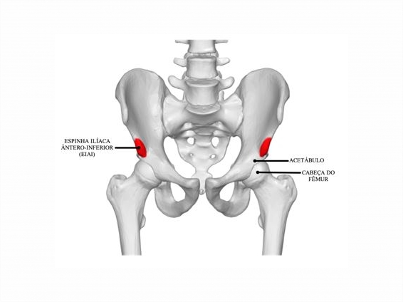 Pubalgia do Atleta - Dr. Anderson Luiz Oliveira